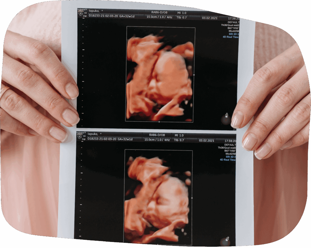 Fetal Development