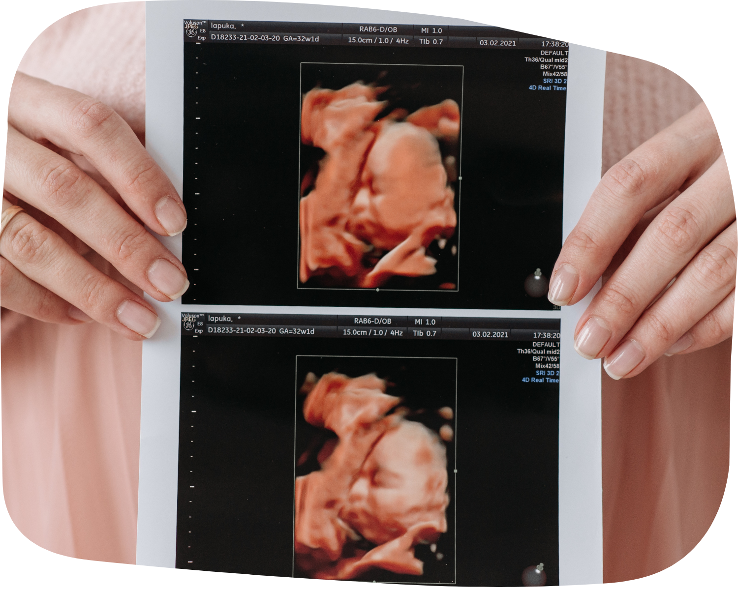 Fetal Development